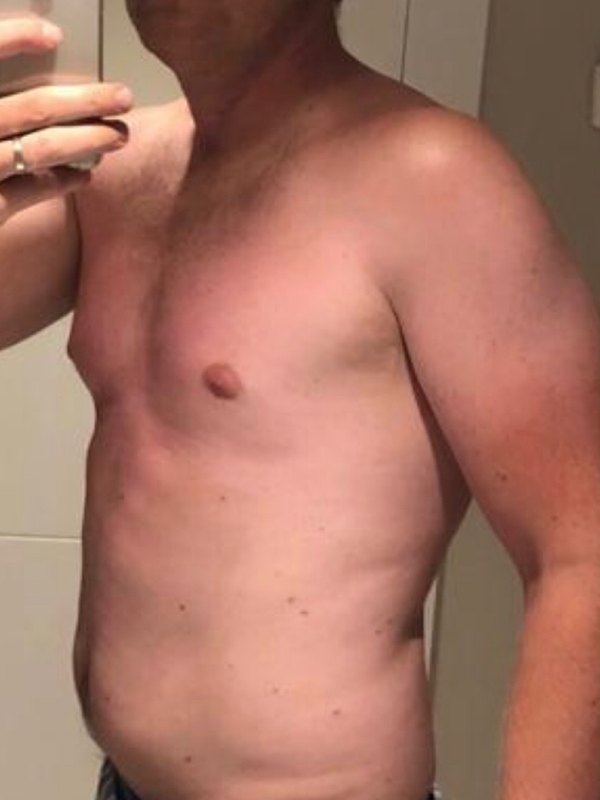 Client transformation — before