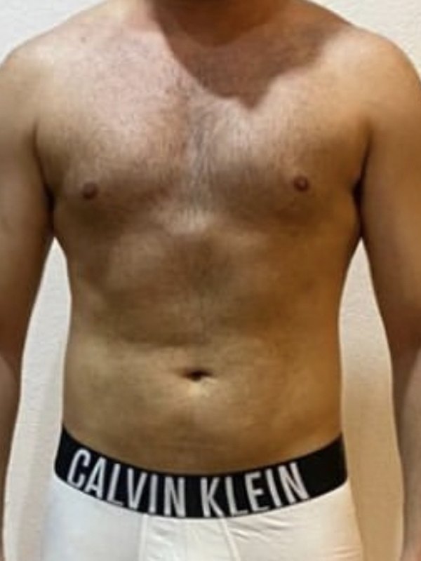 Client transformation — after