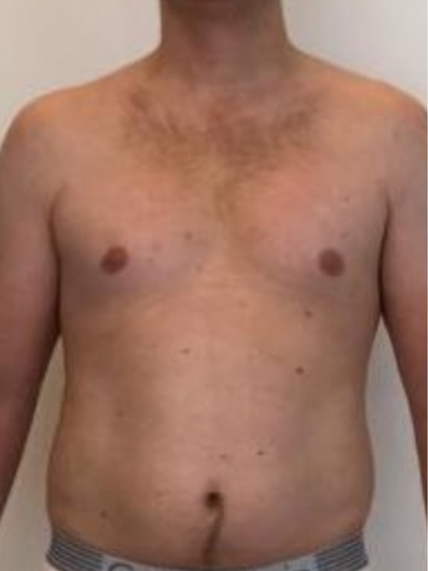 Client transformation — before